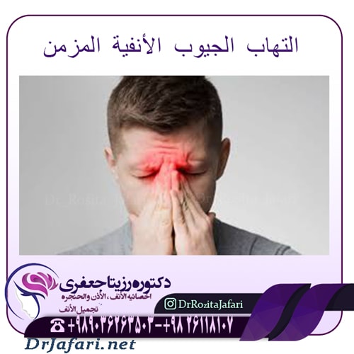 التهاب الجيوب الأنفية المزمن 