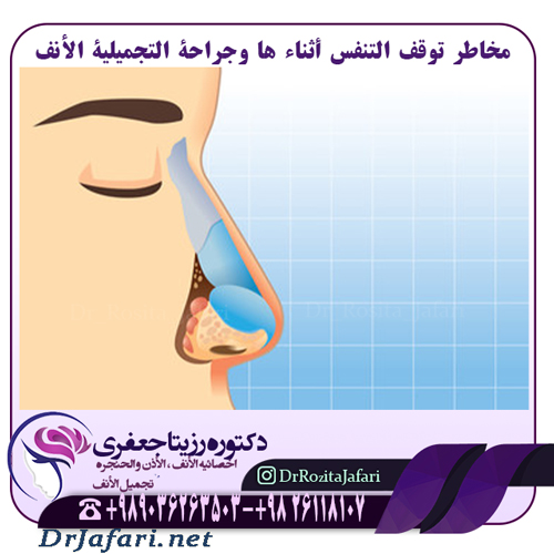 العلاقة بين جودة النوم ومخاطر توقف التنفس أثناء ها و جراحة التجميلیة الأنف